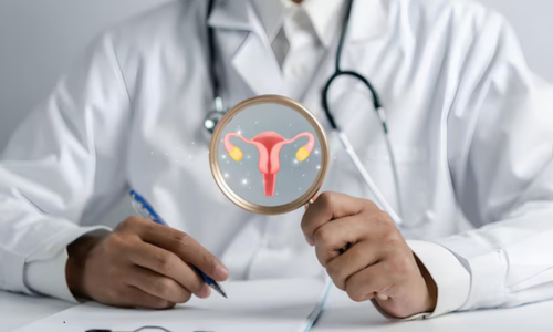 Homeopathic PCOS & PCOD Treatment in Dubai Guide